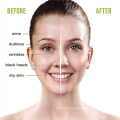 Advanced Avocado Vegan Mask Deep Washing Blackhead Remover Mud Facial Skin Mask